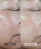 C+ Correcting Complex 30%