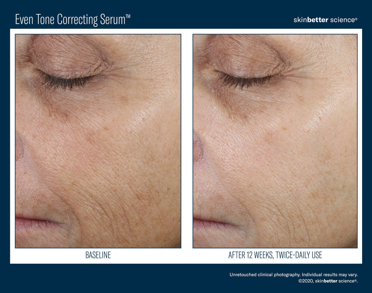 Even Tone Correcting Serum 50 ml