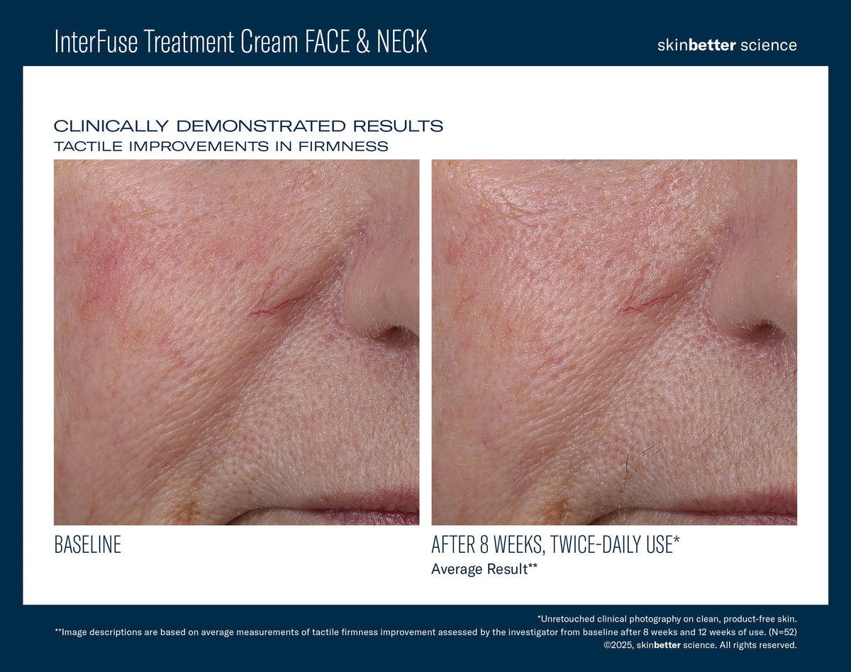 InterFuse Treatment Cream FACE & NECK 30 ml