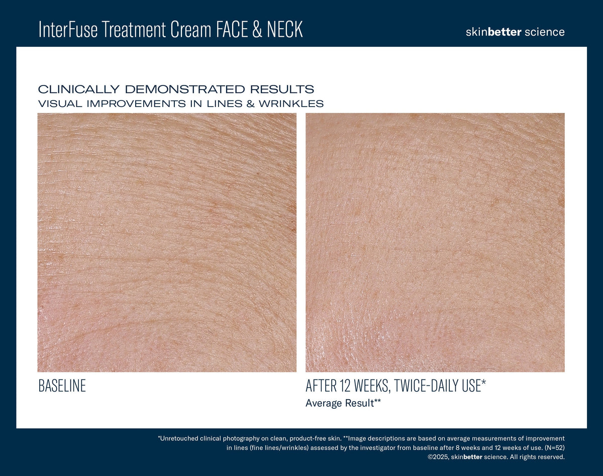 Interfuse InterFuse Treatment Cream FACE & NECK 50 ml – Coachlight Clinic & Spa