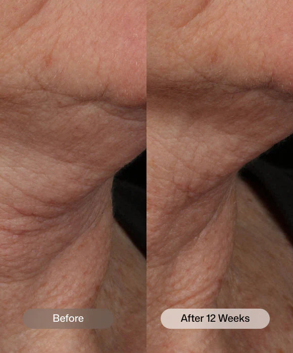 Nectifirm Advanced