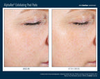 AlphaRet Exfoliating Peel Pads 30 ct