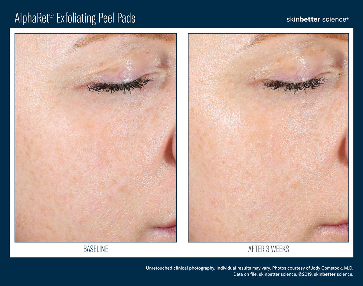 AlphaRet Exfoliating Peel Pads 30 ct