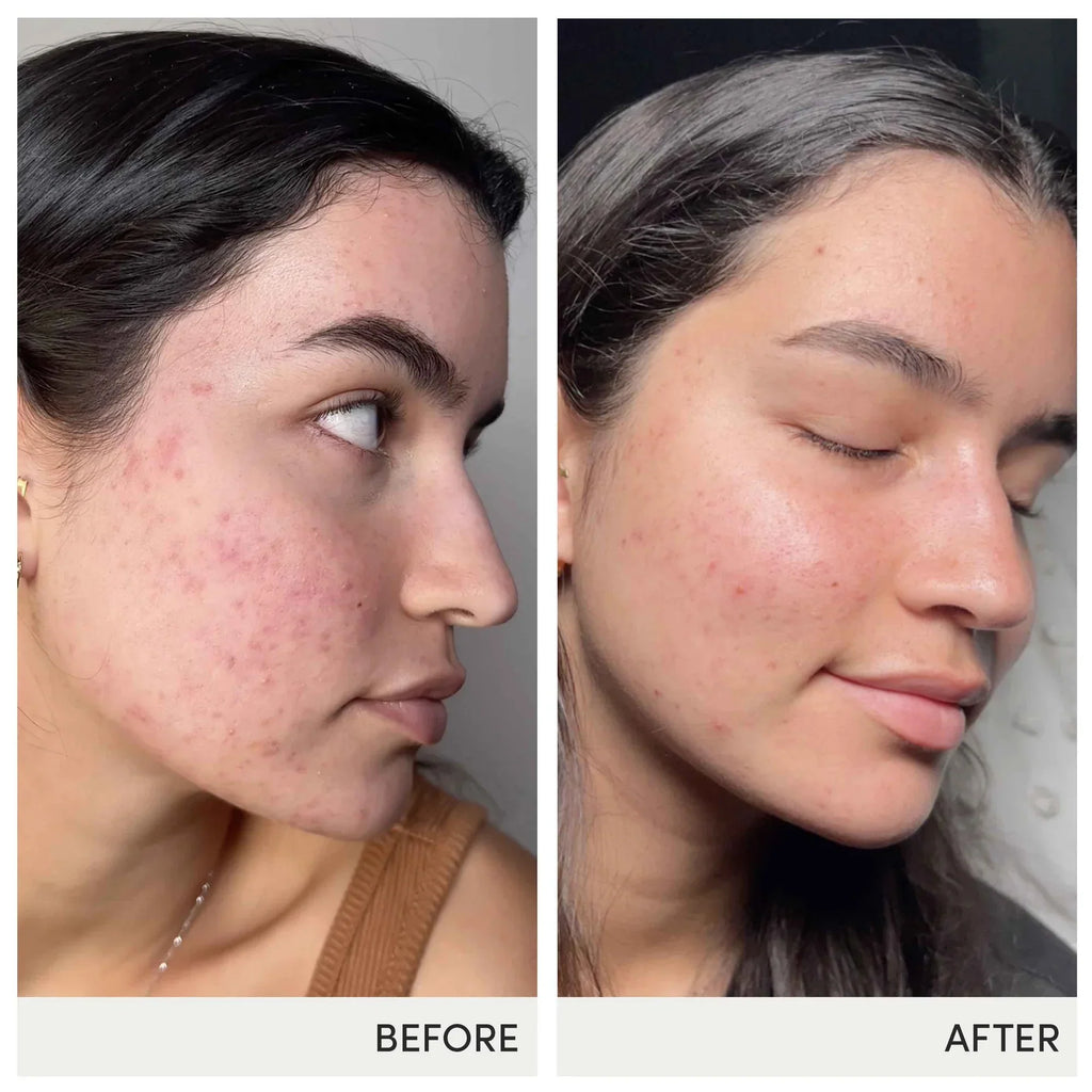 Skin Accumax