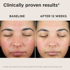 UV Skin Recovery Broad Spectrum SPF50 Face Sunscreen