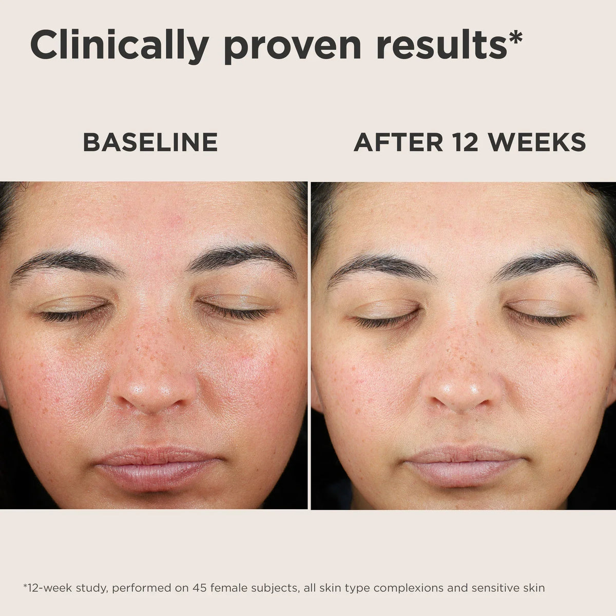 UV Skin Recovery Red Color Correcting SPF50 GREEN TINT