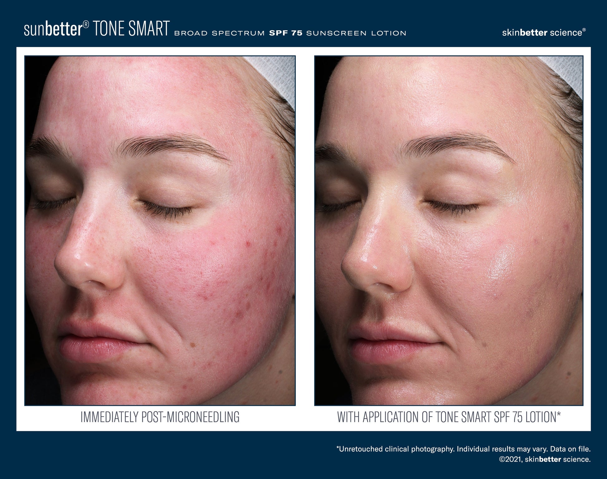 SunBetter TONE SMART SPF 75 Sunscreen Lotion