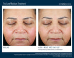 Trio Luxe Moisture Treatment