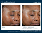 Trio Luxe Moisture Treatment