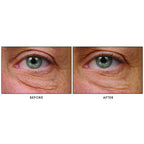 Teamine Eye Complex