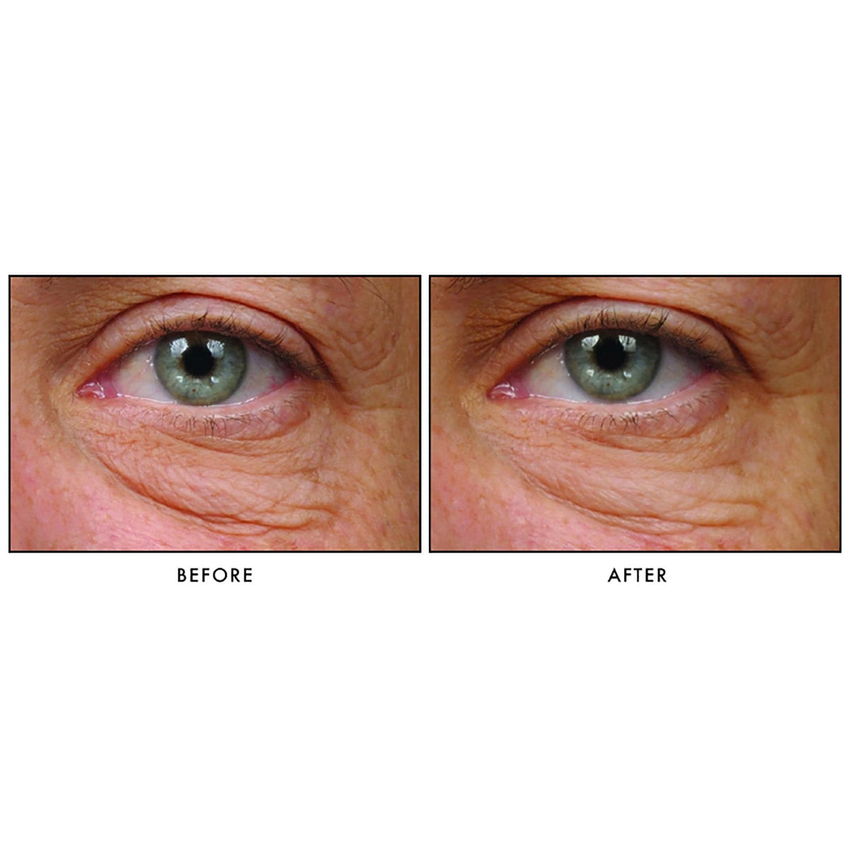 Teamine Eye Complex