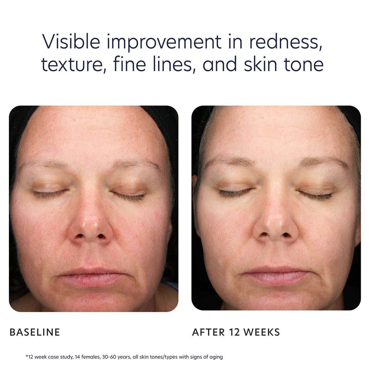 Triple Exfoliation Peel Pads 30 ct