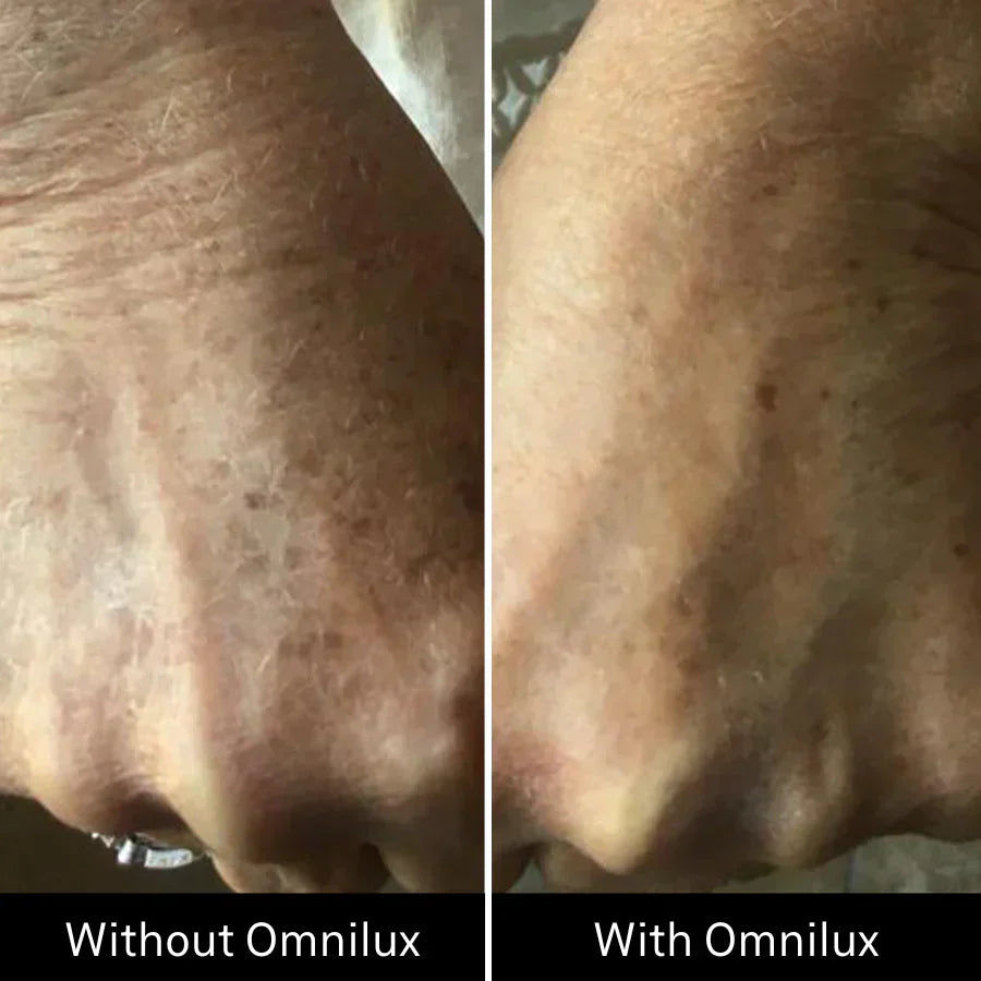 Omnilux Contour Glove