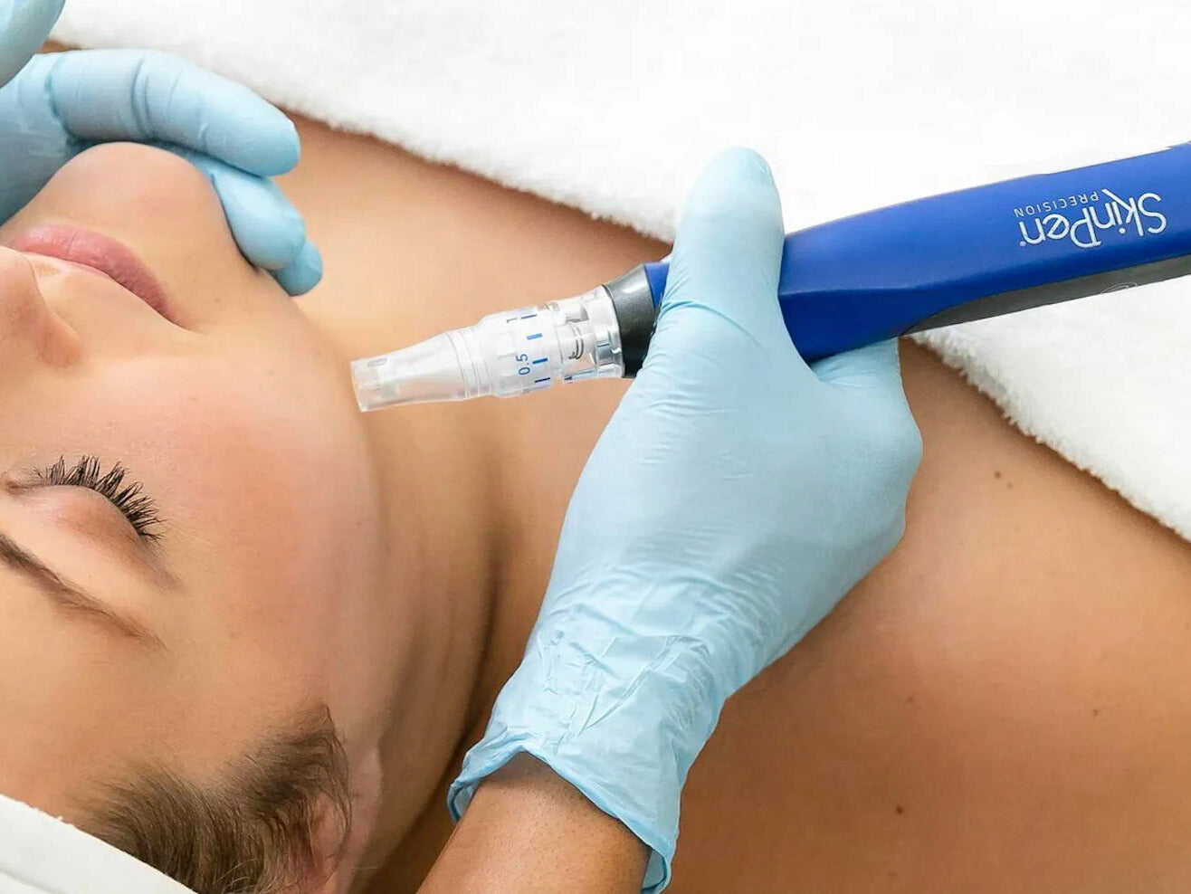 ✨ Collagen Comeback: Microneedling SkinPen Package at Coachlight Ankeny