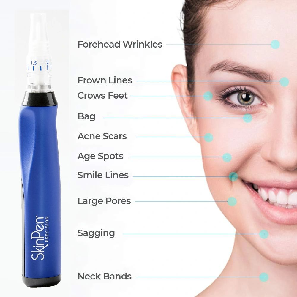 ✨ Collagen Comeback: Microneedling SkinPen Package at Coachlight Ankeny